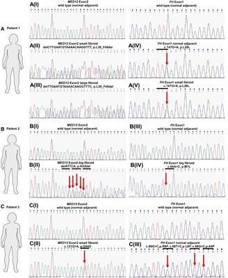 Prevalence and clinical significance of co-existing mutations in MED12 and FH in uterine fibroids of Australian women